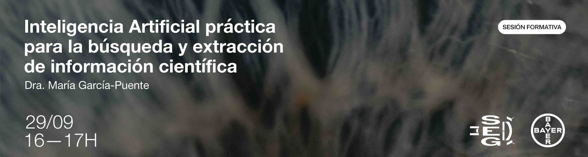 Sociedad Española de Glaucoma