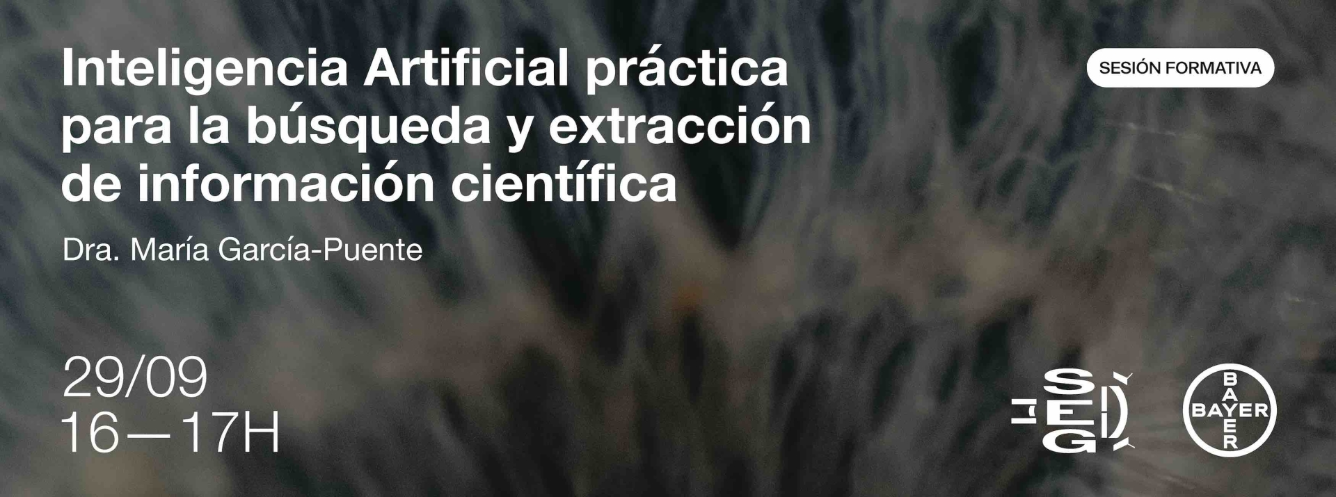 Sociedad Española de Glaucoma